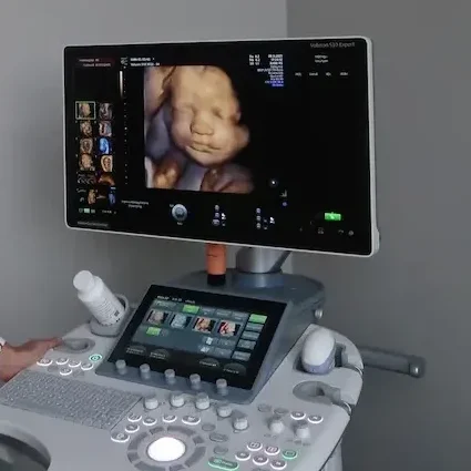 Professionel sonograf ved avanceret ultralydsscanner med 3D-billede af foster i klinik