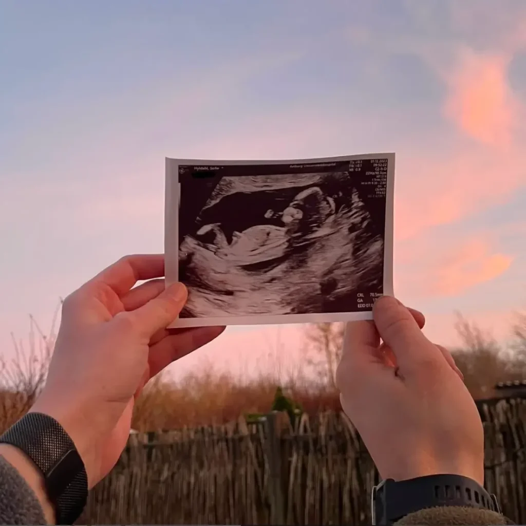 Et par der holder deres hænder på et billede af deres barn