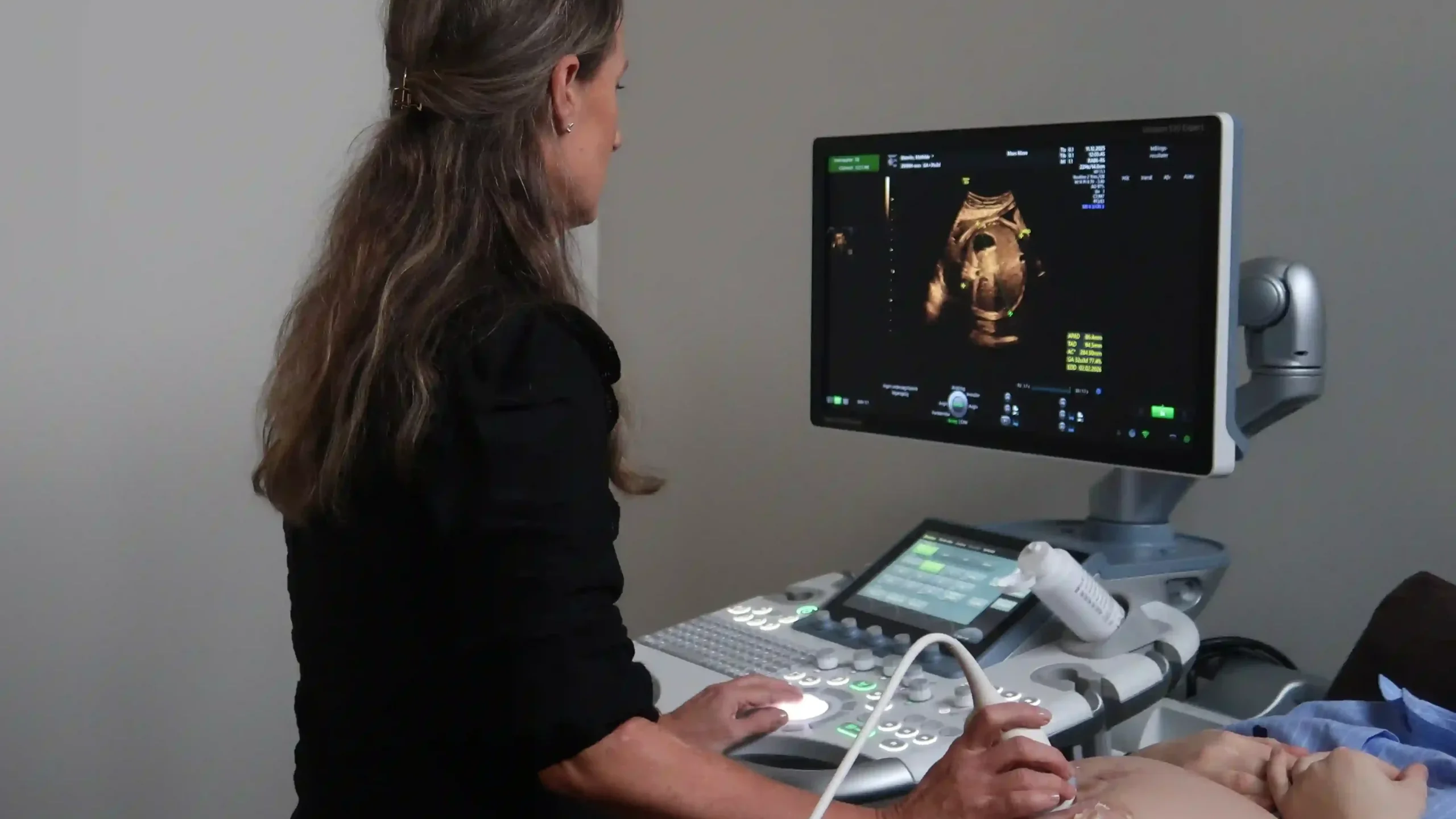 Professionel privat 3D-graviditetsscanning udført med avanceret ultralydsscanner i klinik